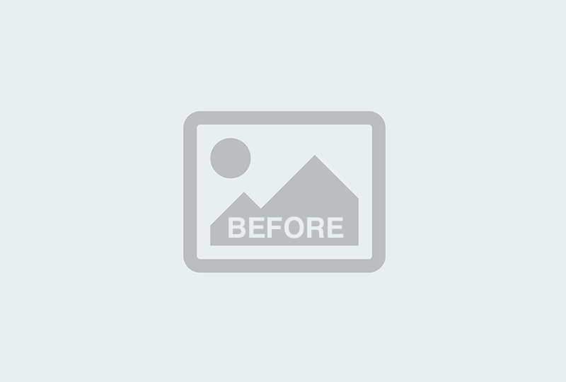 Before Image: Botox – Forehead & Crow’s Feet - front