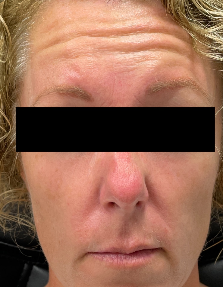 Before Image