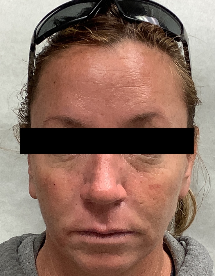 After Image: Filler - front
