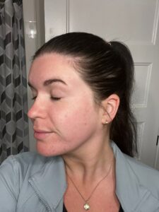 After Image: E-Matrix & Skincare