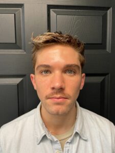 Before Image: Juvederm Filler – Jawline