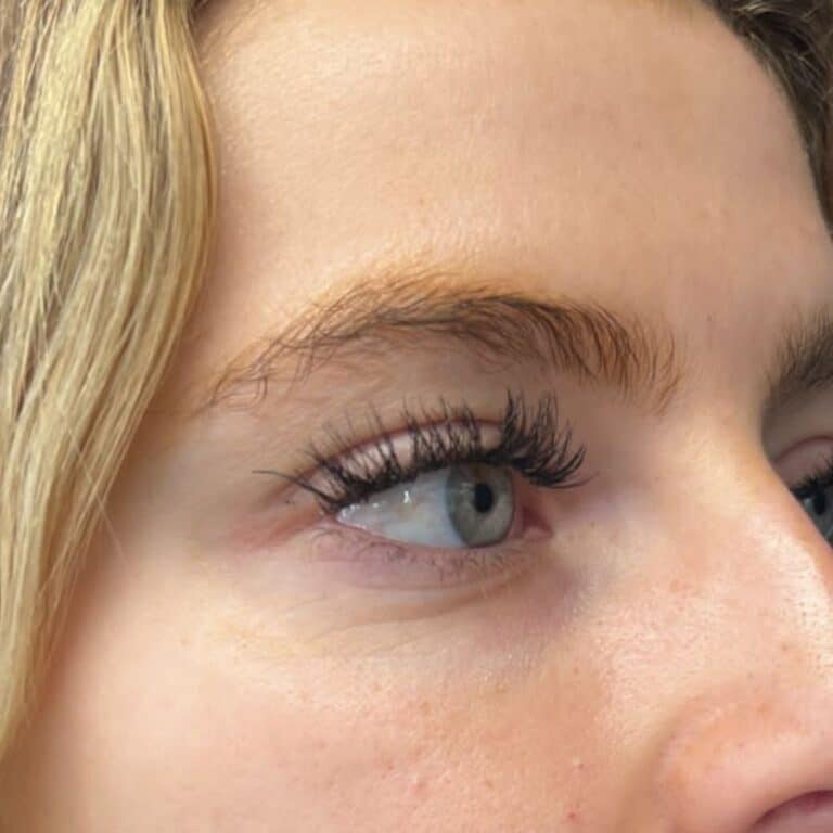 After Image: Under Eye Filler - right-front-oblique