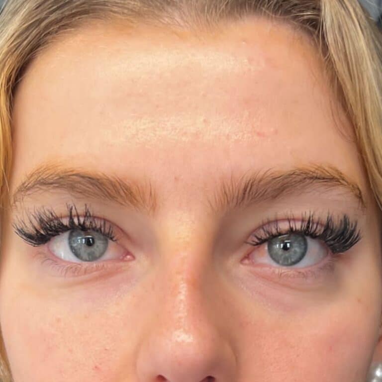 After Image: Under Eye Filler - front