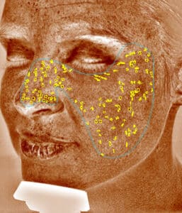 card brown spots