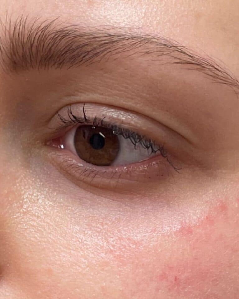 After Image: Undereye Filler - front