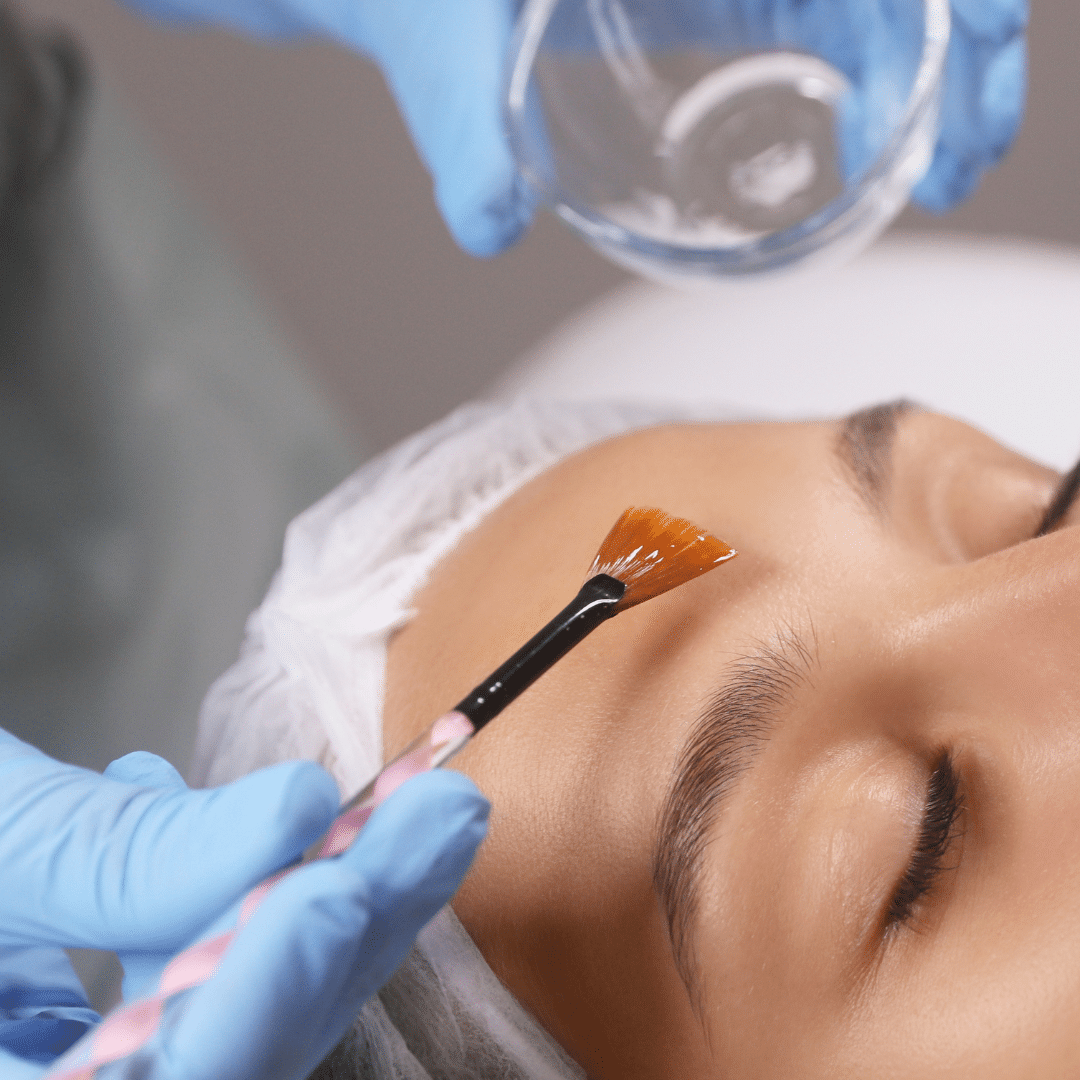 brightening peel